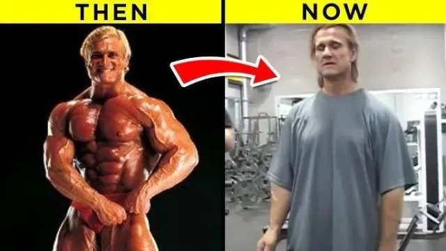Illustration for “It Worked Well for Zac Efron — Is There Any Real Risk to Trying This at Home?”
